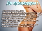 картинка услуги Подмышки сахар