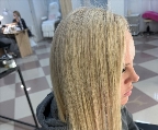 картинка услуги Коррекция височной зоны