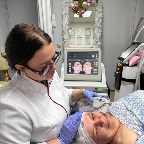 картинка услуги 💯Смас лифтинг - аппарат на основе сфокусированного ультразвука. Его задача - глубоко подтянуть ткани,. стимулировать образование нового коллагена и ук