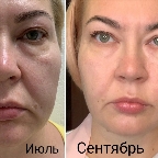 картинка услуги классический массаж лица