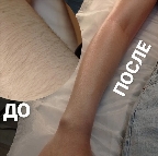 картинка услуги Руки