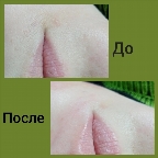 картинка услуги Усики