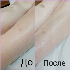картинка услуги Ноги (голень/бедро)