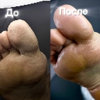 картинка услуги Педикюр(пальчики+стопа) с покрытием