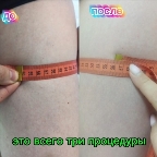 картинка услуги бедра + ягодицы