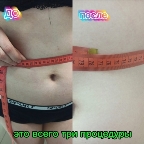 картинка услуги живот + бока