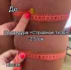 картинка услуги Стройные бедра