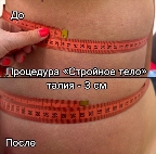 картинка услуги Тонкая талия