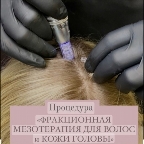 картинка услуги Дермапенизация для кожи головы