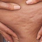 картинка услуги Body-трансформация