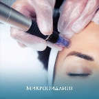 картинка услуги микронидлинг