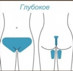 картинка услуги Глубокое бикини