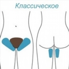 картинка услуги Классическое бикини
