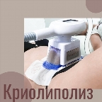 картинка услуги Криолиполиз