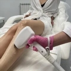 картинка услуги Лазерная эпиляция