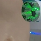 картинка услуги Горячий вакуум для тела и Rf лифтинг 2 зоны